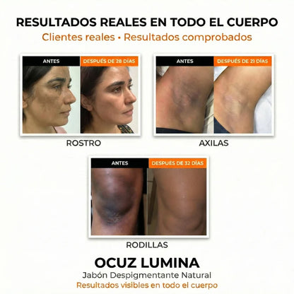 Jabon Kojic: Aclarante Natural, Facial y Corporal. Fórmula Única en Paraguay