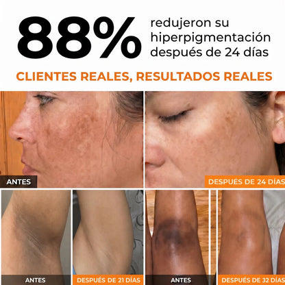 Jabon Kojic: Aclarante Natural, Facial y Corporal. Fórmula Única en Paraguay