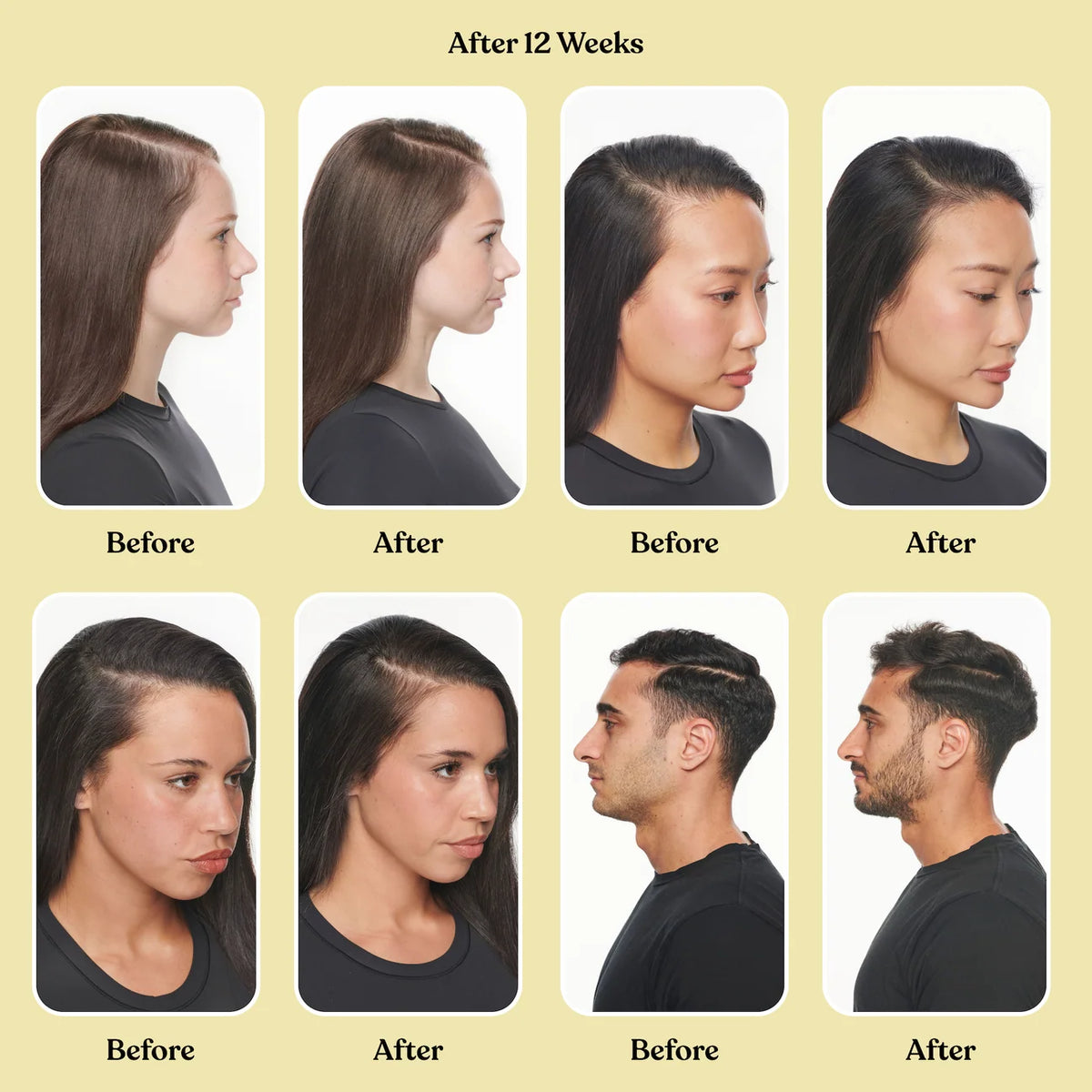 Lemme Grow: Crecimiento del cabello y anticaída* (sin biotina)